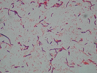 Gram Staining of Bacteria